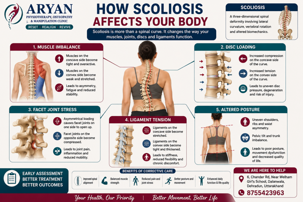 Educational medical infographic illustrating how scoliosis affects the body through muscle imbalance, uneven disc loading, facet joint stress, ligament tension, and altered posture, with detailed anatomical diagrams and clinical information from Aryan Physiotherapy, Osteopathy & Manipulation Clinic in Dehradun.